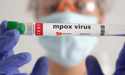 secretaria-de-saude-confirma-segundo-caso-de-mpox-do-grupo-lp-em-sp