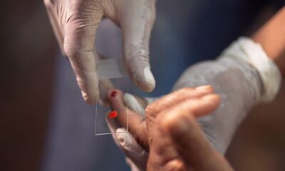 sus-comeca-a-usar-novo-tratamento-contra-a-malaria-em-criancas