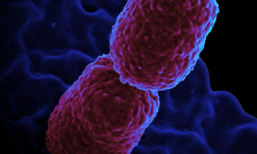 hospital-em-campinas-restringe-atendimento-para-conter-superbacteria