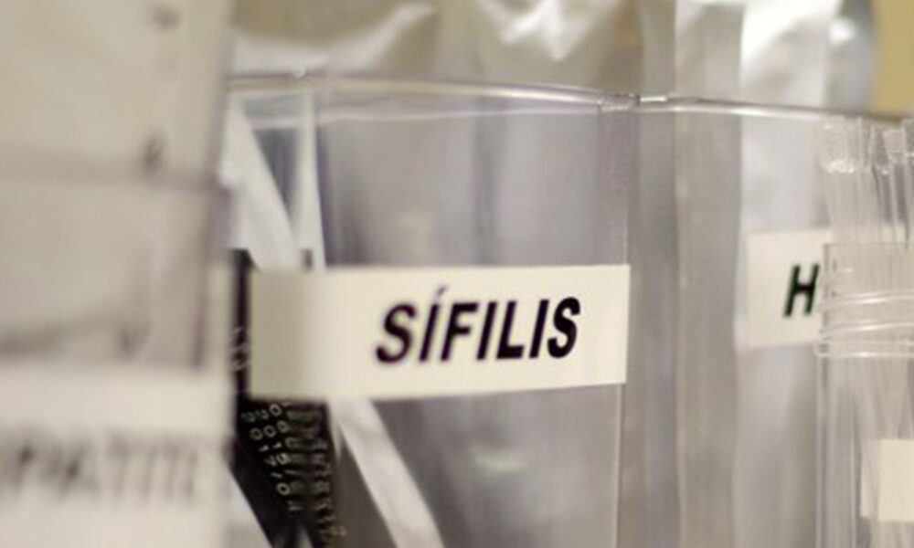 centro-de-sp-tem-testagem-gratis-de-hiv,-hepatite,-siflis-e-gonorreia