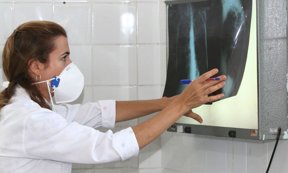 oms-recomenda-testes-de-diagnostico-rapido-para-erradicar-tuberculose