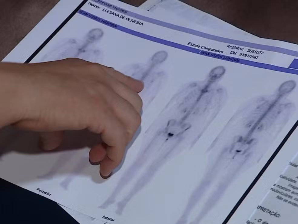 Imagem G1 - Reprodução EPTV