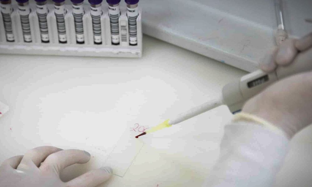 exames-descartam-ebola-em-imigrante-da-republica-democratica-do-congo