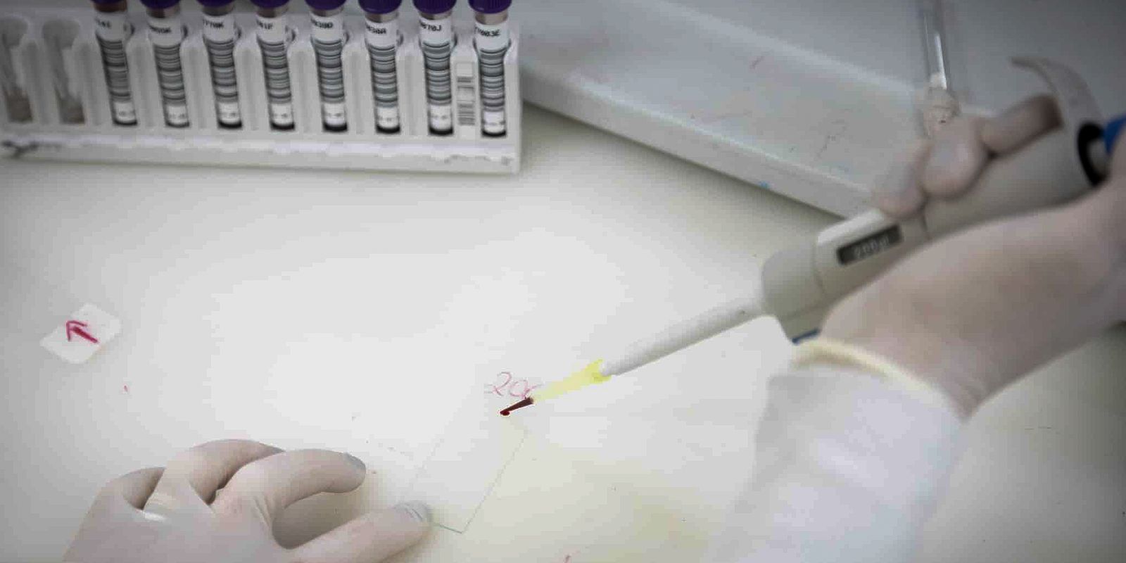exames-descartam-ebola-em-imigrante-da-republica-democratica-do-congo