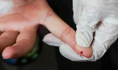 brasil-atinge-meta-de-reducao-da-transmissao-vertical-de-hepatite-b