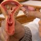 aberta-chamada-publica-para-pesquisas-sobre-endometriose