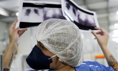 diagnostico-tardio-da-poucas-chances-de-cura-para-o-cancer-de-pulmao