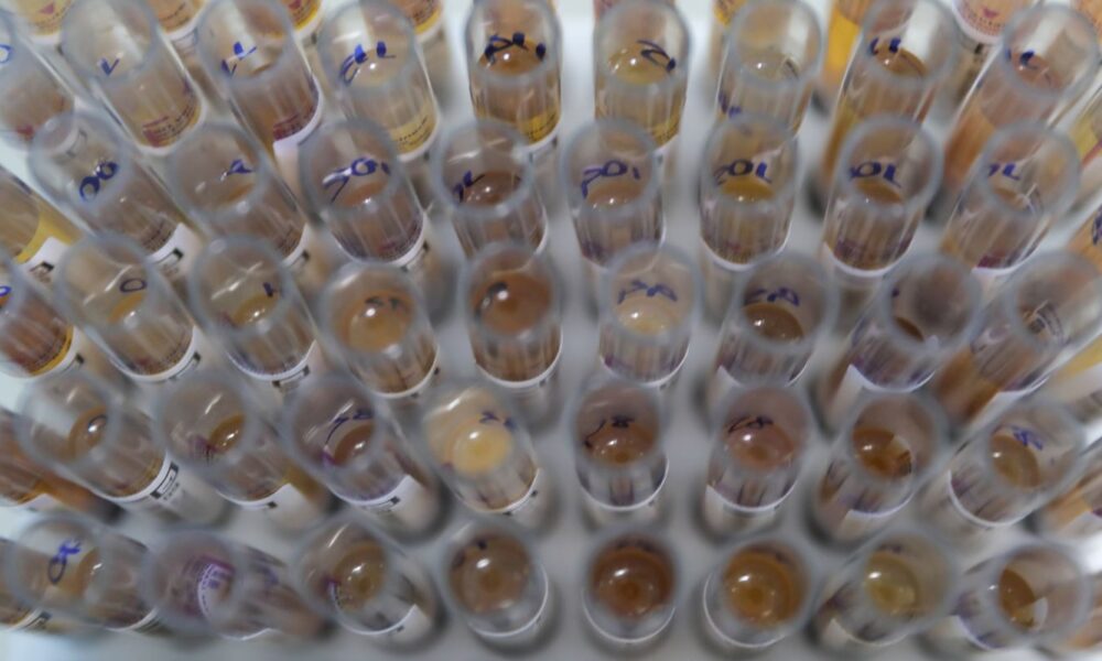 uso-de-medicamento-oferecido-no-sus-reduz-casos-de-malaria-no-brasil