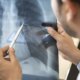 tabagismo-e-maior-entre-jovens-de-16-a-24-anos,-alerta-pesquisa