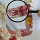 em-13-anos,-doenca-inflamatoria-intestinal-cresce-5-vezes-no-brasil