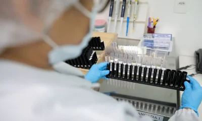 malaria:-anvisa-autoriza-teste-em-humanos-de-vacina-100%-brasileira